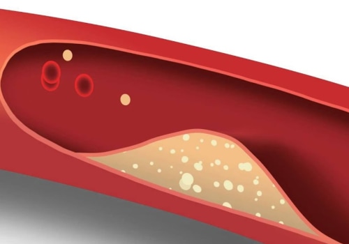High Blood Pressure: Understanding the Risks and Benefits